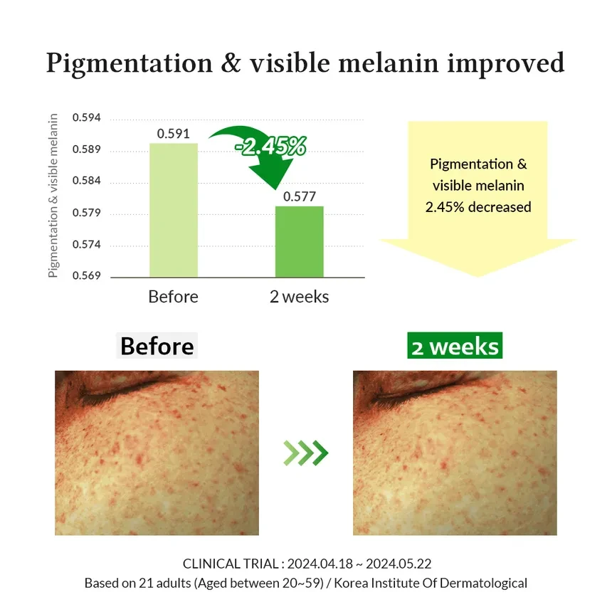 DR. ALTHEA Gentle Vitamin C Serum 30ml